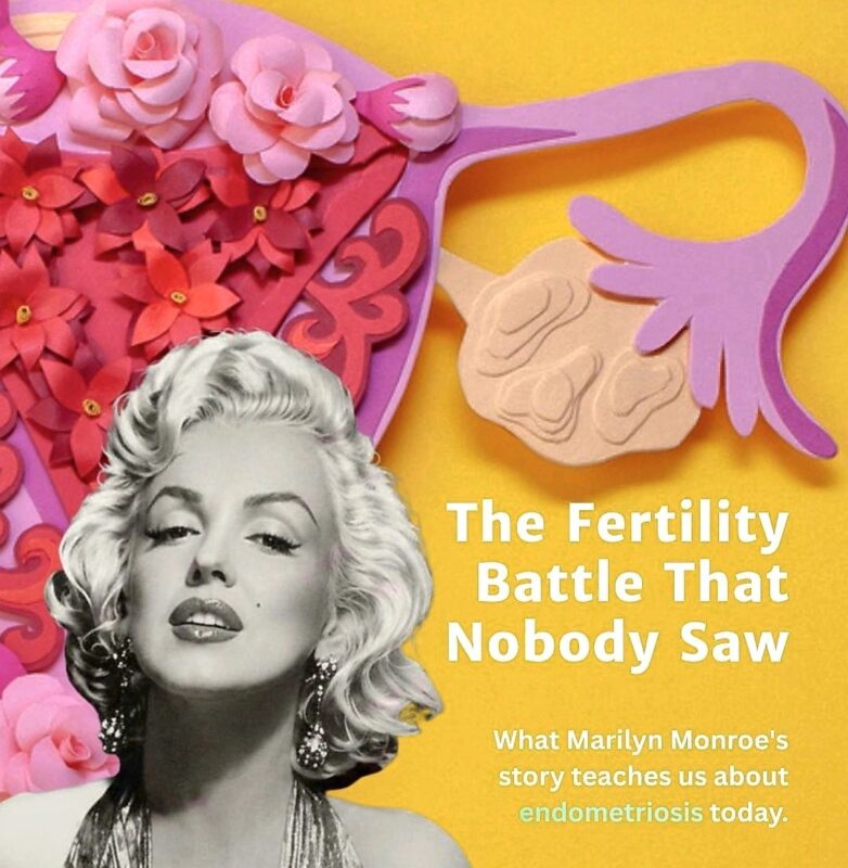 Marco Zaccaria: How Did Endometriosis Affect Marilyn Monroe’s Life?
