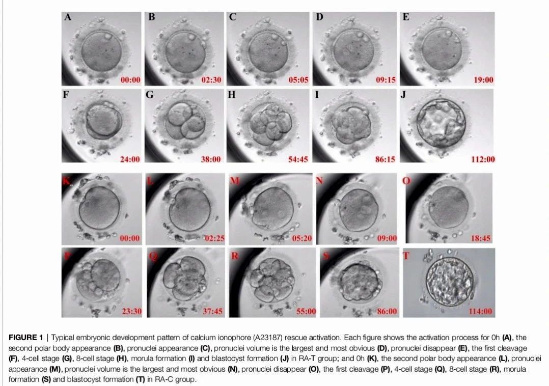 Esraa Atef: Is 24 Hours Too Late to Rescue Unfertilized Oocytes?