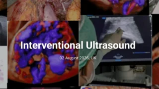 Mastering Interventional Ultrasound with Francesco D’Antonio - ISUOG