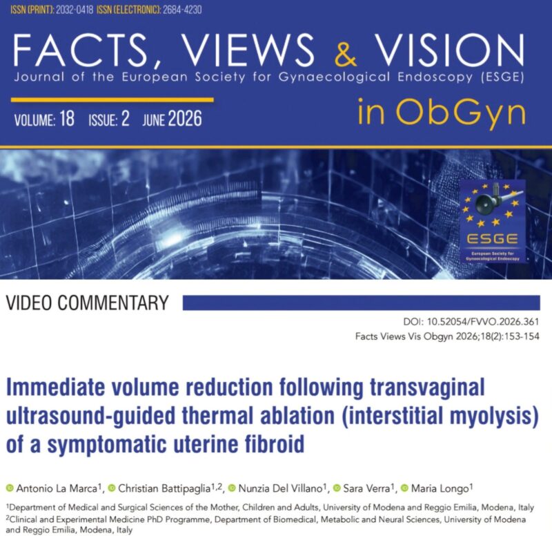 Marco Zaccaria: Transvaginal Microwave Thermoablation for Uterine Fibroids