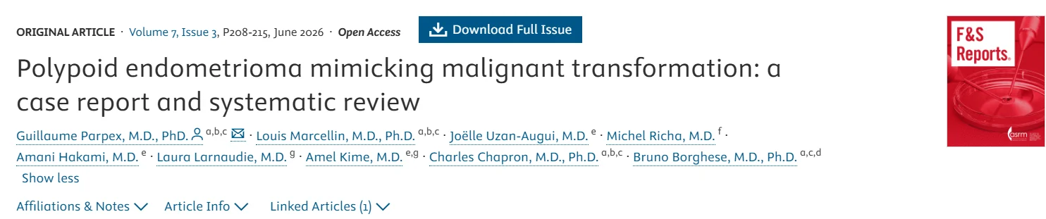 Polypoid Endometrioma Mimicking Malignant Transformation – Fertility and Sterility