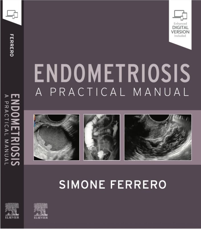 Simone Ferrero: The Diagnosis of Endometriosis, From Vision to Publication