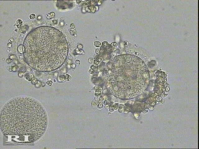 Hosam Mokbel: Our Trainee Embryologists Performed Their First Oocyte Denudation