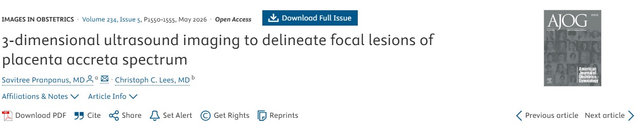 Christopher Robinson: 3D Ultrasound Tramline Sign to Delineate Focal lesions of Placenta Accreta Spectrum