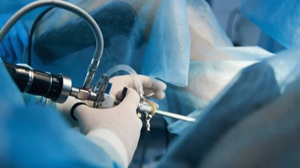 Does Endometrial Scratching Improve IVF Success? – Fertility Plus