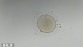 Hosam Mokbel: Our Trainee Embryologists Performed Their First Oocyte Denudation