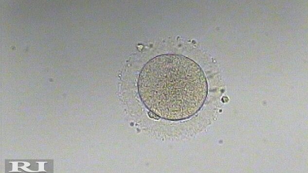 Hosam Mokbel: Our Trainee Embryologists Performed Their First Oocyte Denudation