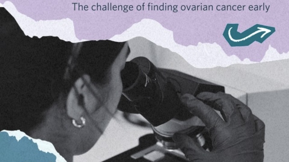 Why Do We Need an Early Detection Test for Ovarian Cancer? – OCRF