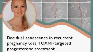 Progestin Analogues Effectively Restore FOXM1 Expression but Leave Key Gaps - RBMO