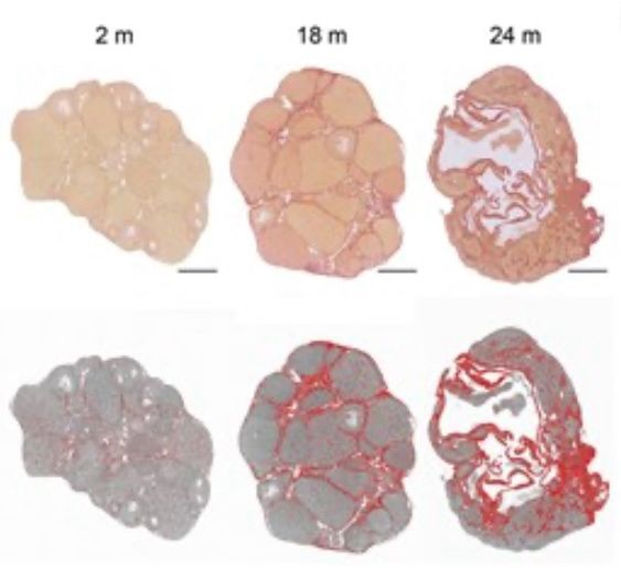 The Post-Reproductive Ovary Shifts From a Reproductive to an Immune-Like Organ – ReproScientifics – SpermTracer