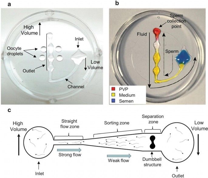 Akansha Negi: Can a Tiny Chip Help Us Select Better Sperm for IVF?