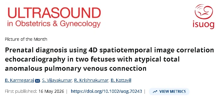UOG Journal Highlights Unusual Total Anomalous Pulmonary Venous Connection Case – ISUOG
