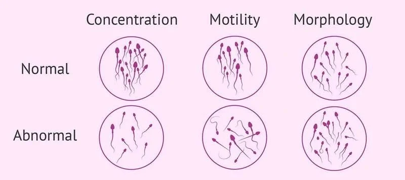 Wendie Pasterick Aston: Male Fertility Testing Shouldn’t Be Overlooked