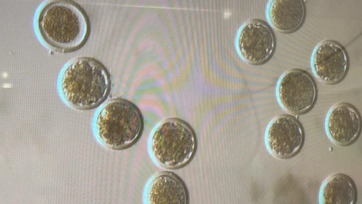 Ahmed Elhlily: Ovine and Bovine IVF, From Oocytes to Blastocysts