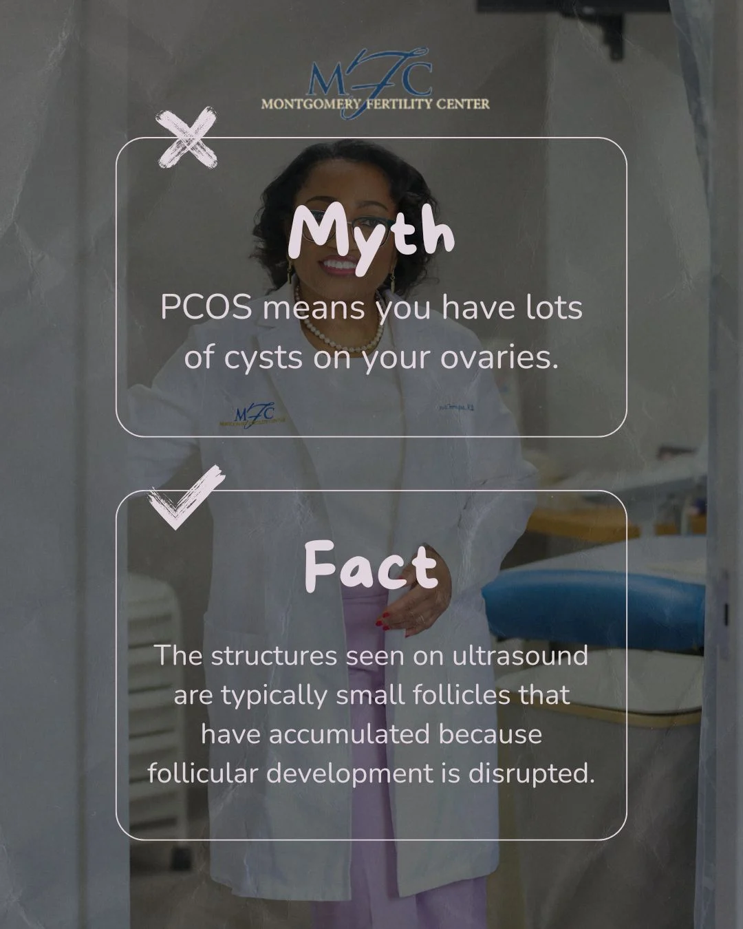 PCOS Doesn’t Necessarily Mean You Have “Lots Of Cysts” on Your Ovaries – Montgomery Fertility Center