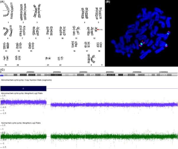 Tushar Chauhan: Why Some Chromosomal Disorders are Challenging to Diagnose