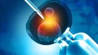 Asmaa Khaled: The Success of IVF is Not Determined By the Number of Eggs Retrieved Alone...