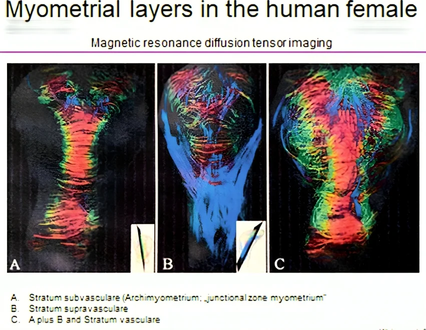 Archimyometrium, Myometrial layers