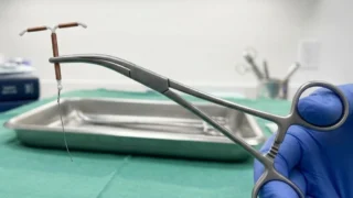 Zenebe Shumye: Every Patient Has the Right to Say Yes or No