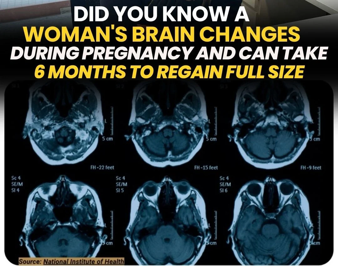 Shweta Mendiratta: Did You Know a Woman’s Brain Changes During Pregnancy?