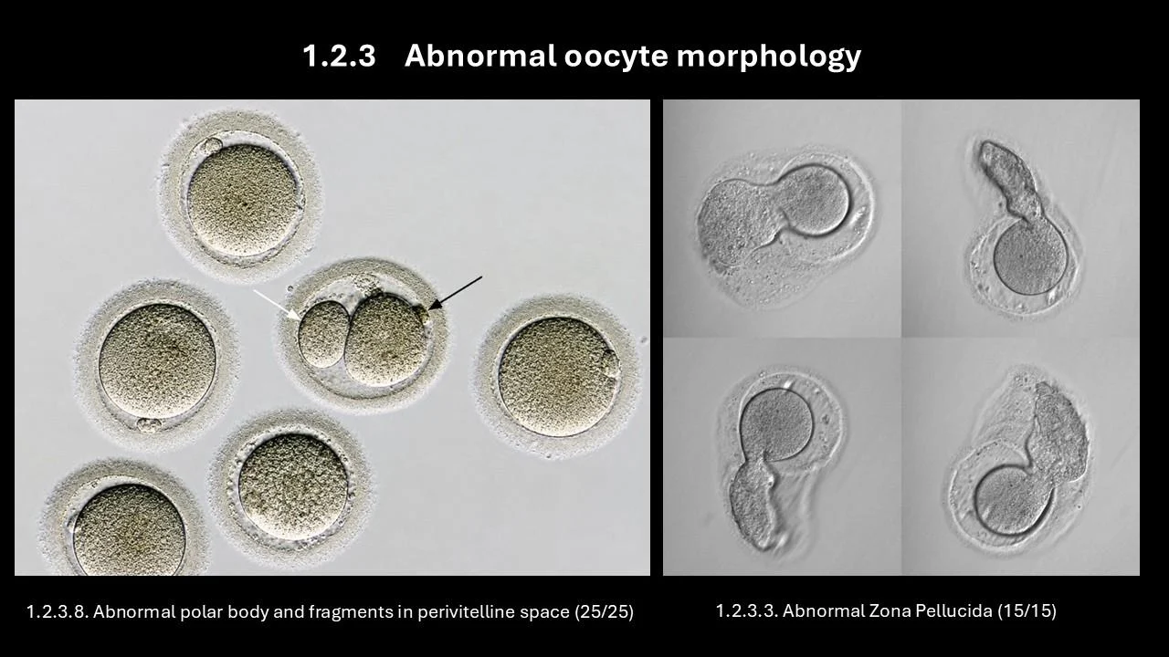 Zuzana Holubcova։ The Latest Additions to eAtlas of Clinical Embryology