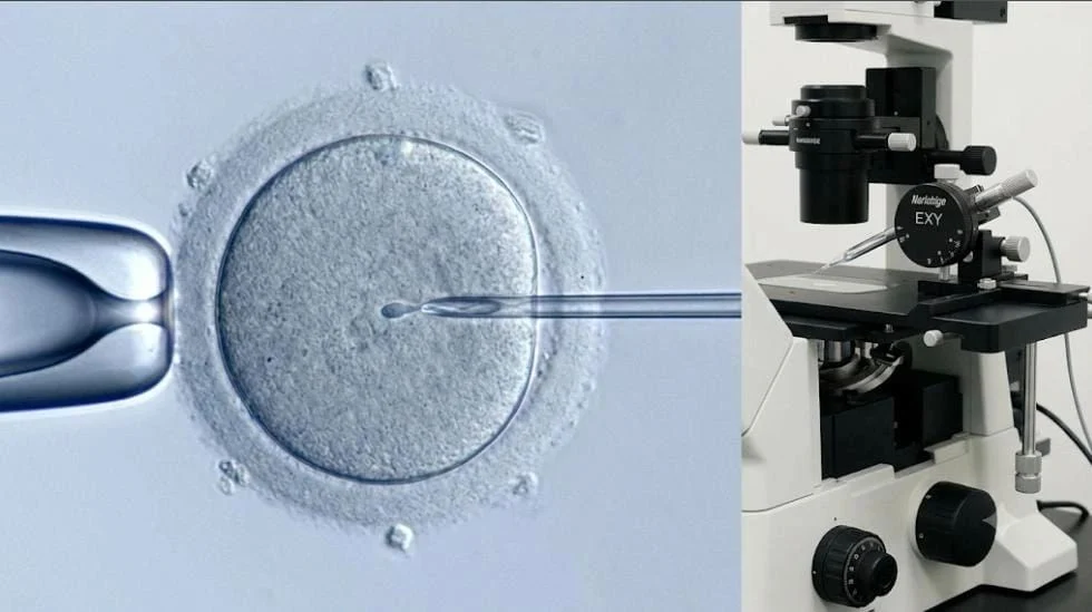 Anuradha Housnur: ICSI Is Not About Injecting the Sperm…