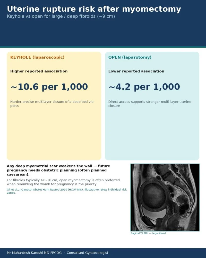 Mahantesh Karoshi: Any Deep Myometrial Scar Needs Obstetric Planning in a Later Pregnancy