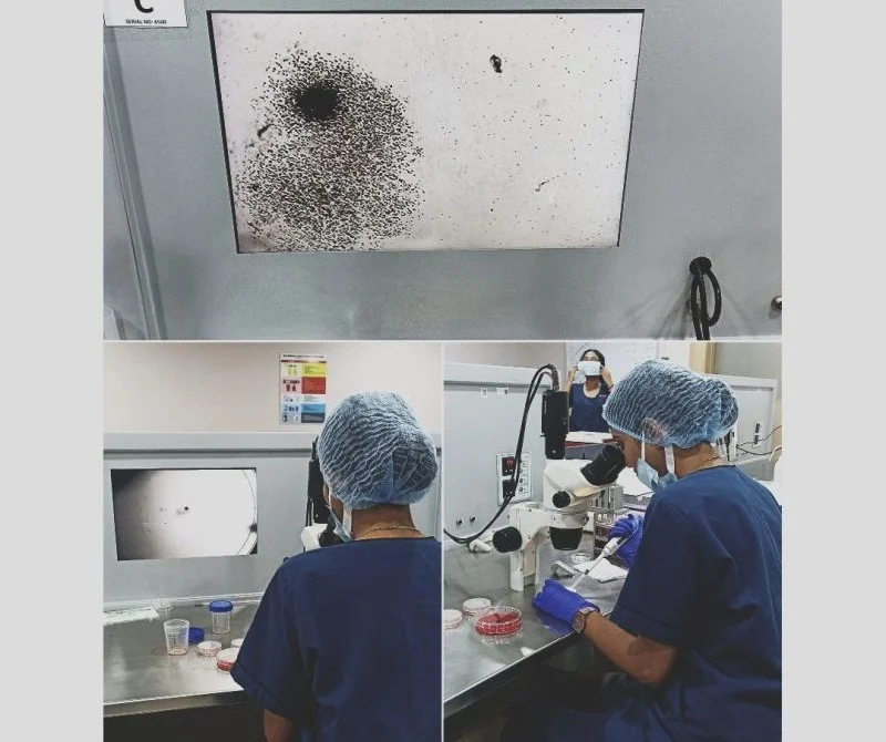 Anjali: My 1st Oocyte Found – A Moment I’ll Always Cherish