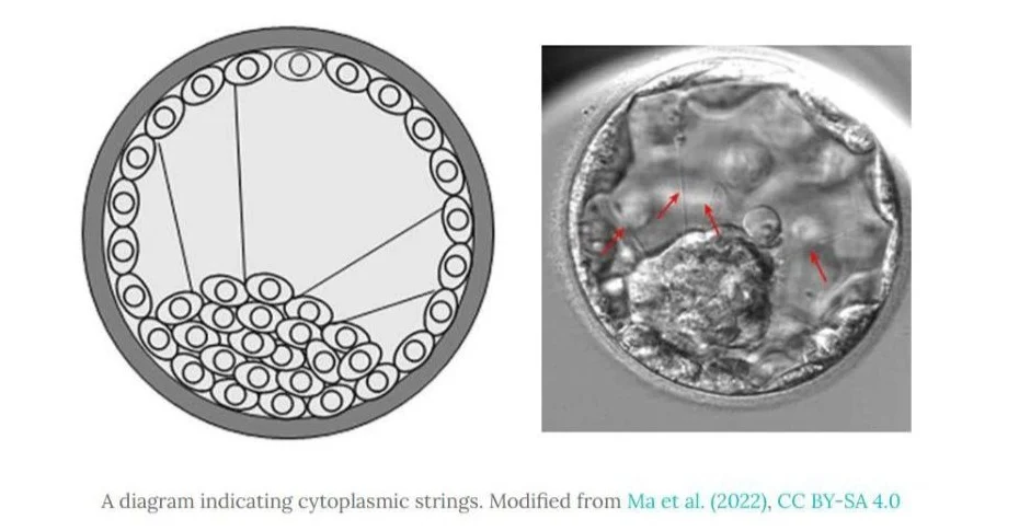 Khalil Faaed։ The Embryo’s Cytoplasmic Strings May Reveal a Hidden Conversation