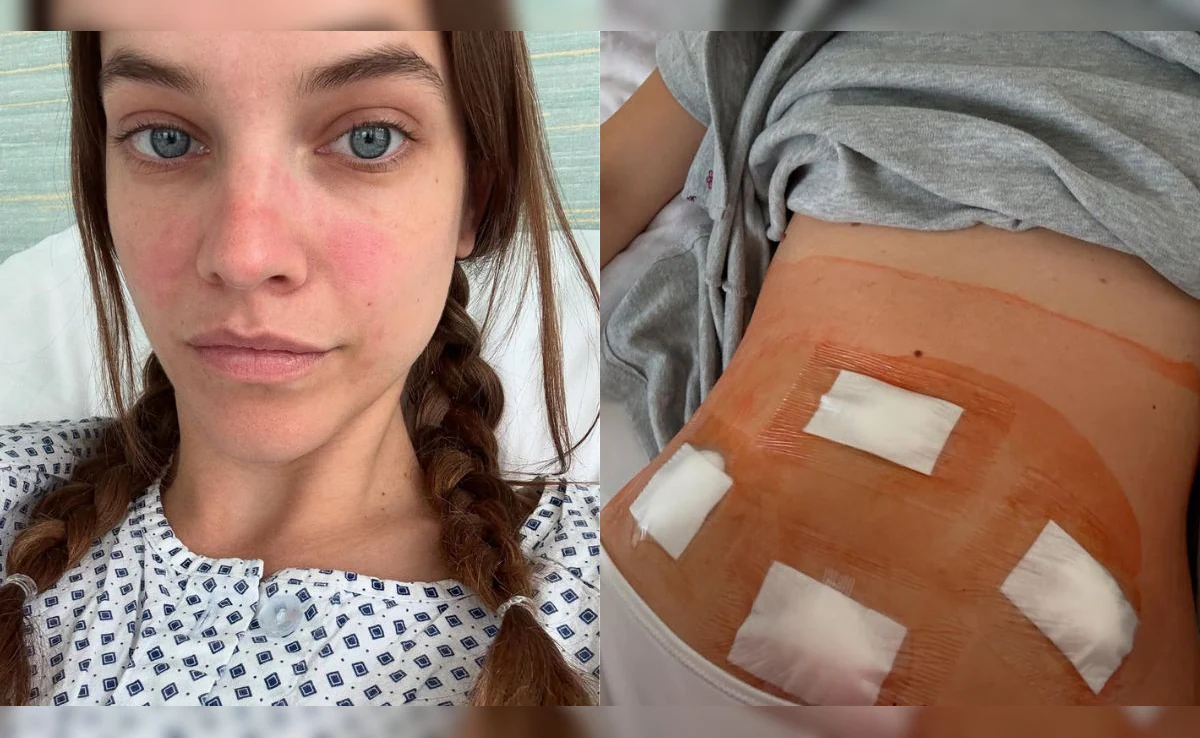Barbara Palvin Welcomes Her First Child After Sharing Her Journey with Endometriosis