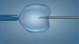 Somil Singhal: Modern ICSI Protocols