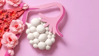12 Myths about PMOS - Fertility Plus