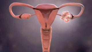 Breaking Another PMOS Myth - PCOS Awareness Association