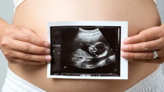 Ultrasound Case Challenge - The Society for Maternal-Fetal Medicine