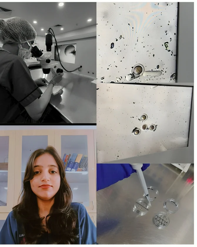 Anjali: My First Oocyte Denudation – A Small Step, But a Huge Milestone
