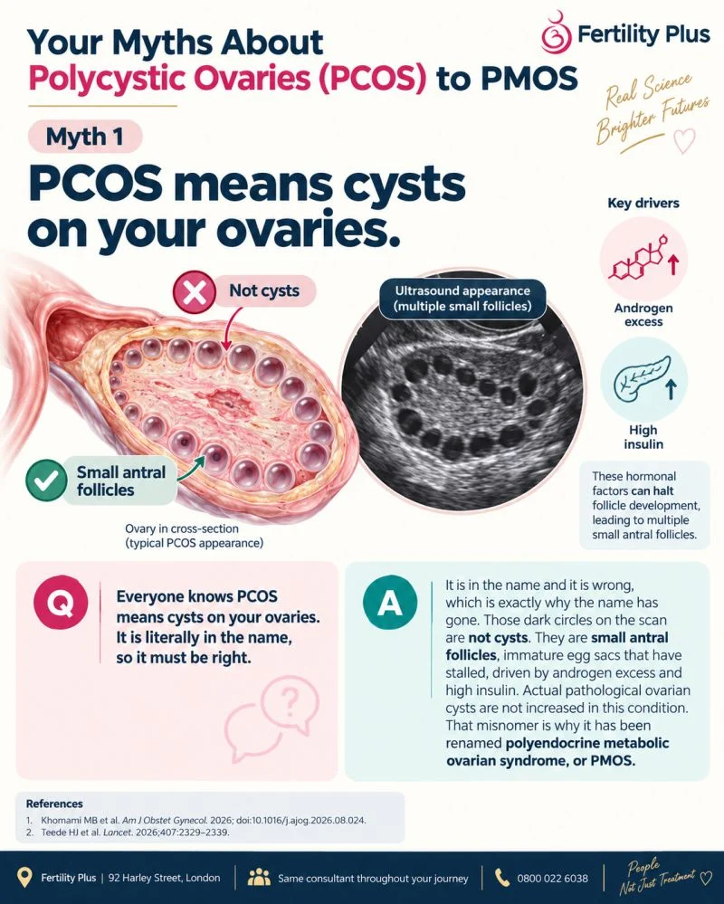 12 Myths about PMOS – Fertility Plus