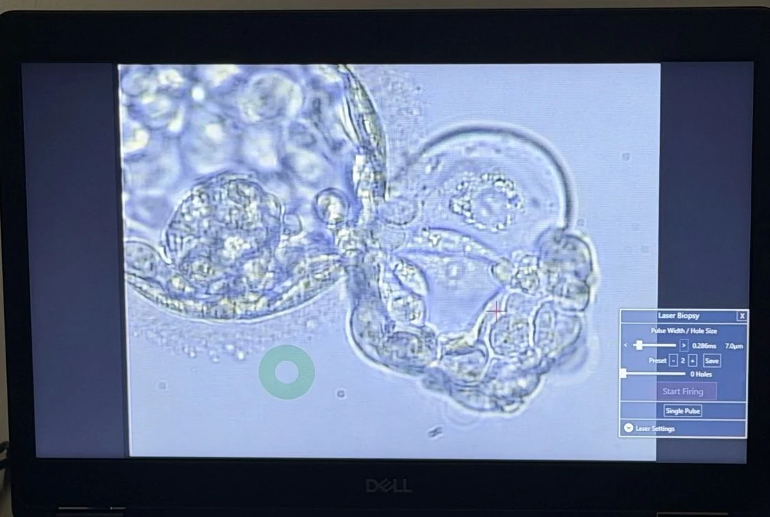 Dilpreet Banwait: Within Something as Small as a Blastocyst Is an Incredible Amount of Biological Information