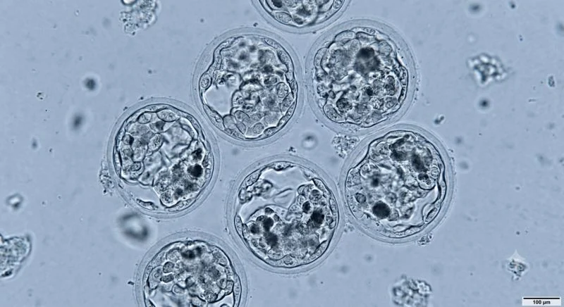 Esther Eleboh: A Collapsed Blastocyst Does Not Necessarily Mean a Bad Embryo