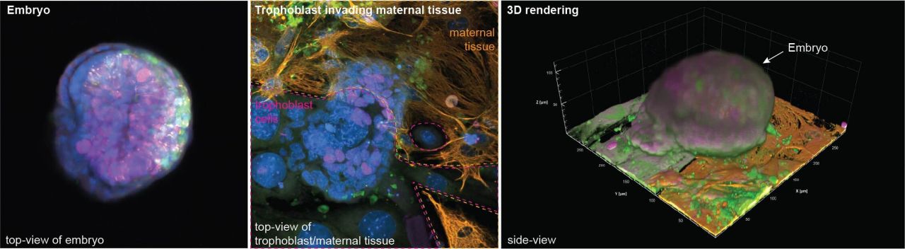 Hugo Villanueva: Building the Fetal-Maternal Interface