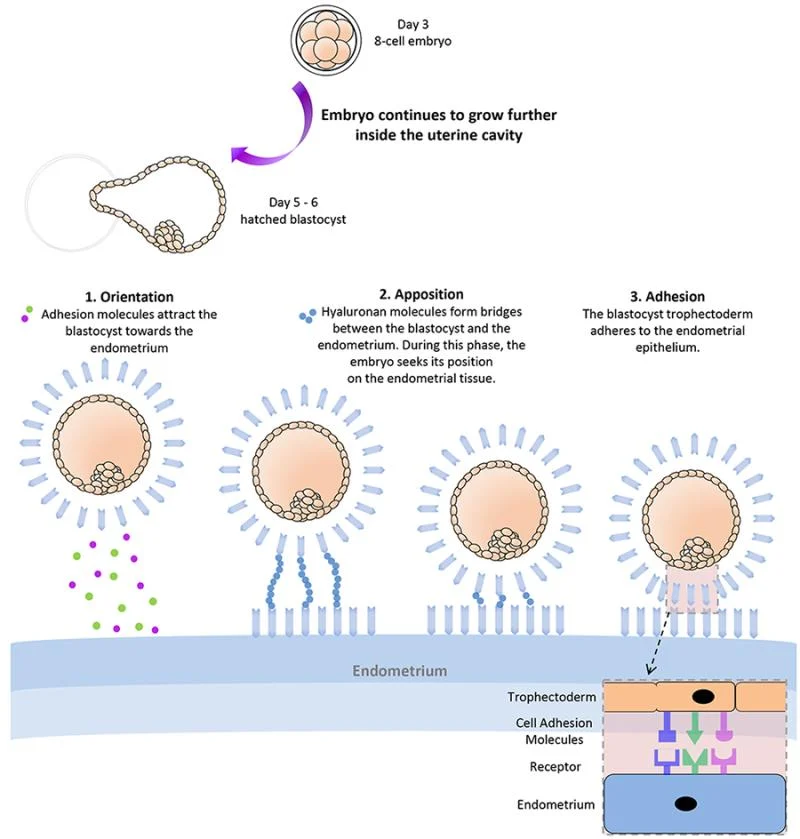 Somil Singhal: Method for Enhancing Embryo Implantation Using Embryo Glue and Its Importance