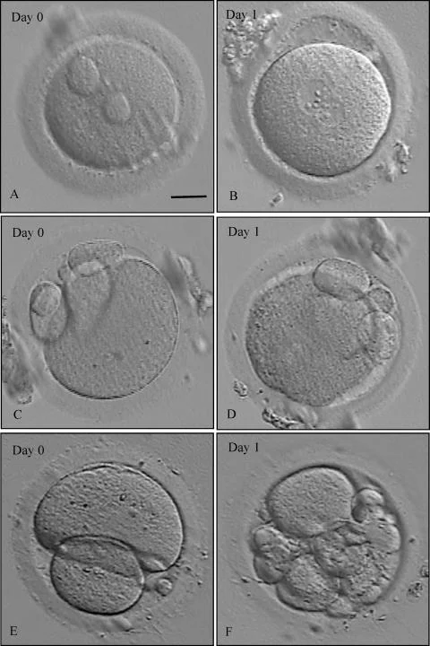 Somil Singhal: The Last Crucial Step in the IVF Journey