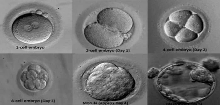 Somil Singhal: The Last Crucial Step in the IVF Journey