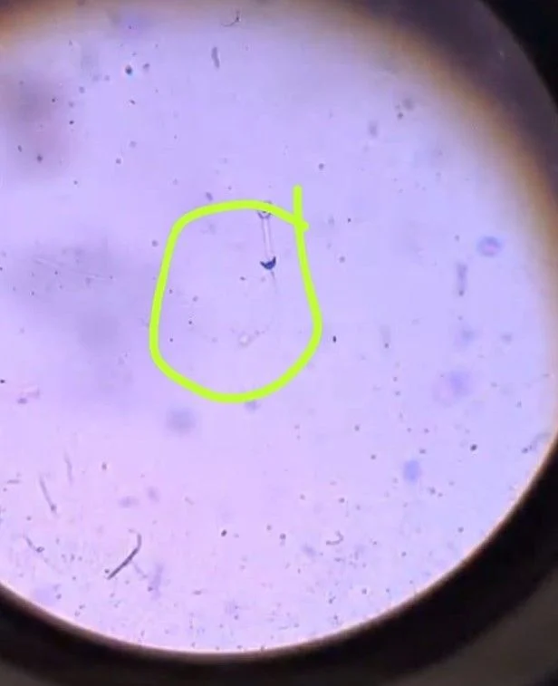 Bhargavi K.: Sometimes, the Most Interesting Part of Embryology Isn’t Finding an Answer