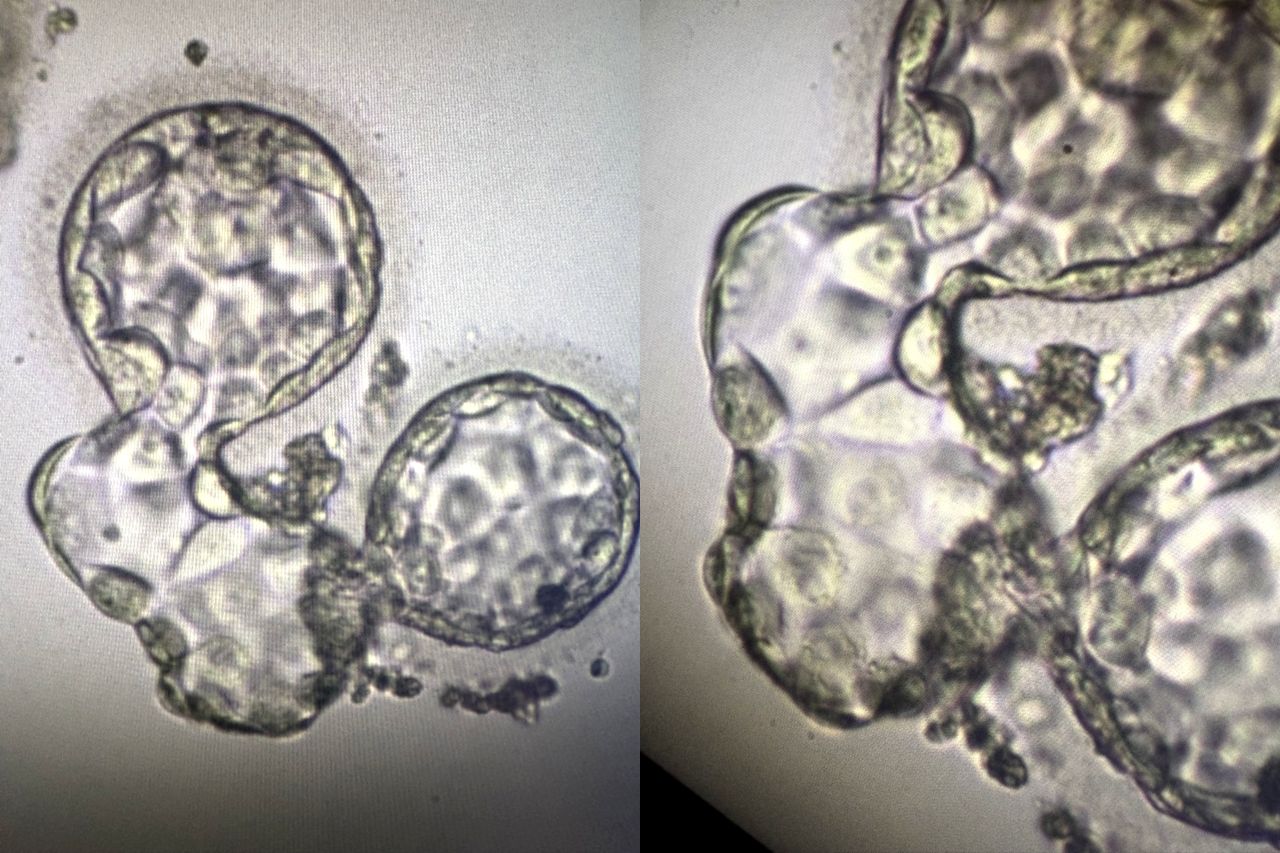 Zuzana Holubcova: 1,000 Items in the eAtlas of Clinical Embryology