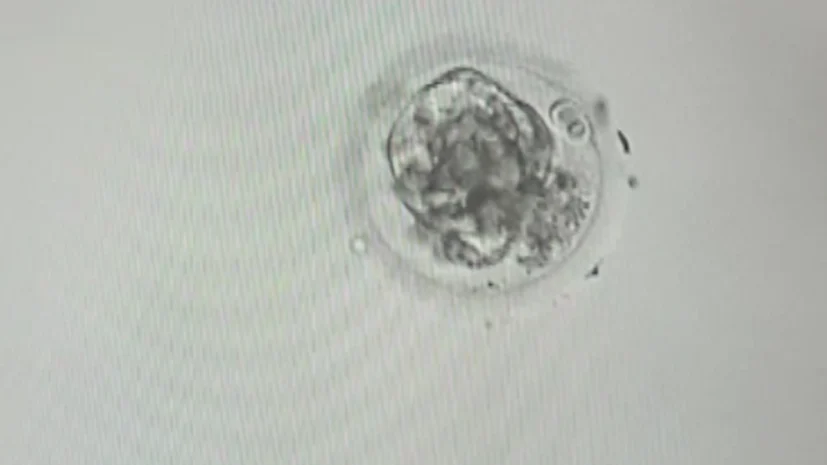 Krishitha Sivalingam: Sometimes, Embryos Remind Us Not to Judge Too Soon
