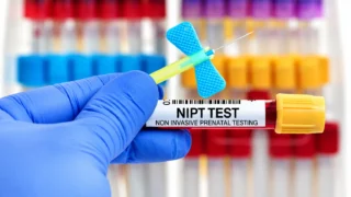 Non-Invasive Prenatal Testing: Science, Counselling, Global Access and Equity - IJGO