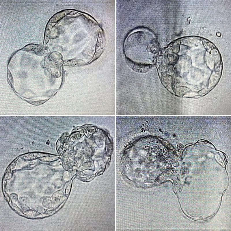 Nourhan Ashour: Fertility Awareness Should Start Long Before IVF