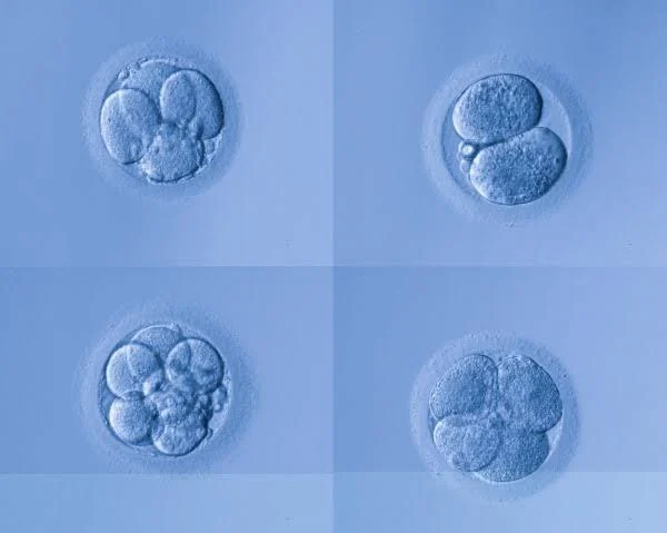 Somil Singhal: Method for Enhancing Embryo Implantation Using Embryo Glue and Its Importance